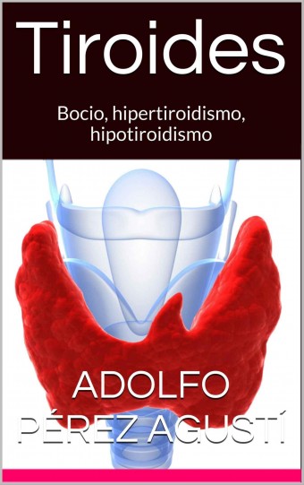 CjOVS Tiroides Bocio, hipertiroidismo, hipotiroidismo   Adolfo Pérez Agusti 